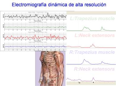 emg_a