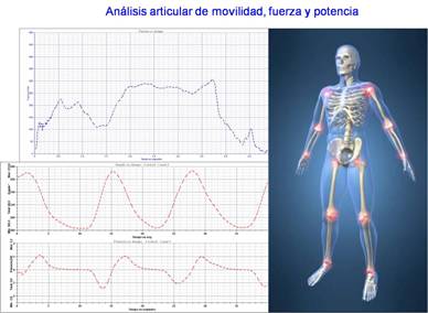 articular